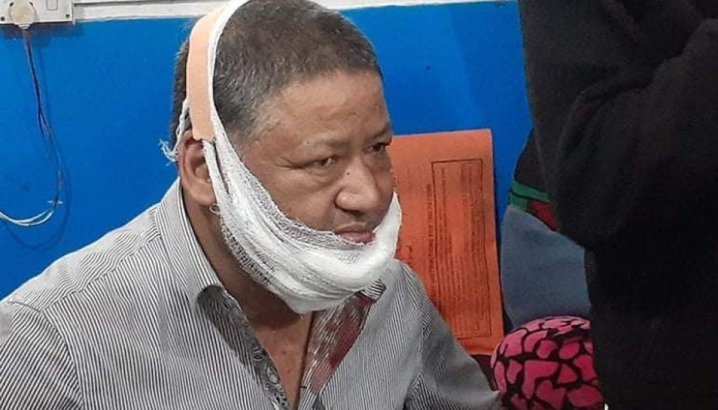 inbound303868577726931373